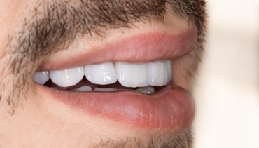 Estetică și Protetică Dentară