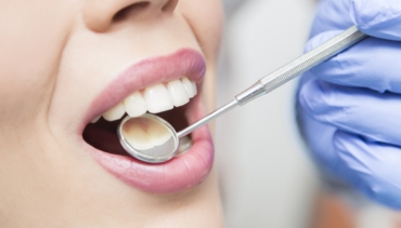 Profilaxie Dentară