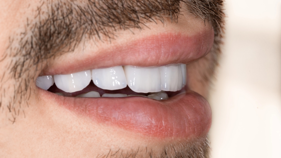 Protetică dentară