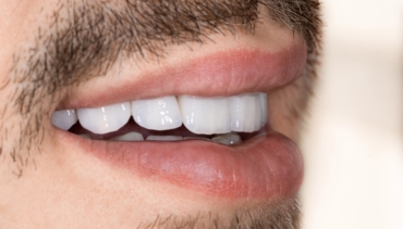 Protetică dentară